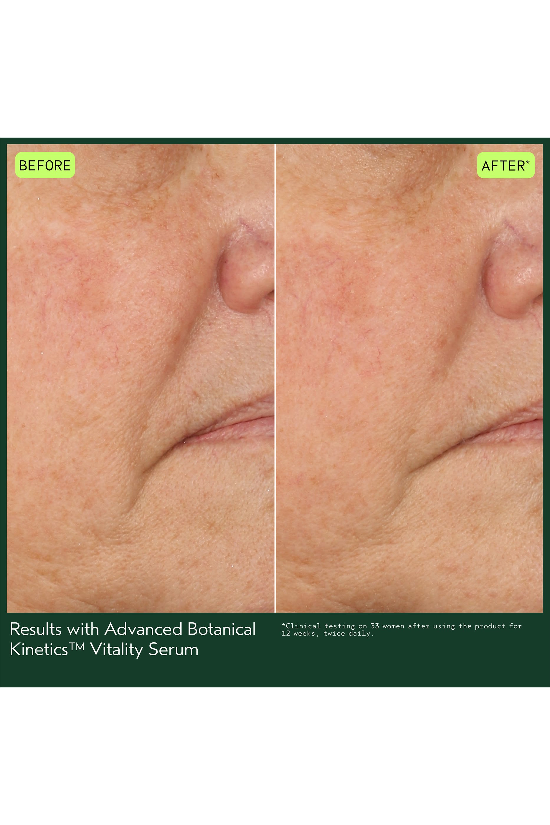 سيروم فايتاليتي أدفانسد بوتانيكال كينيتكس