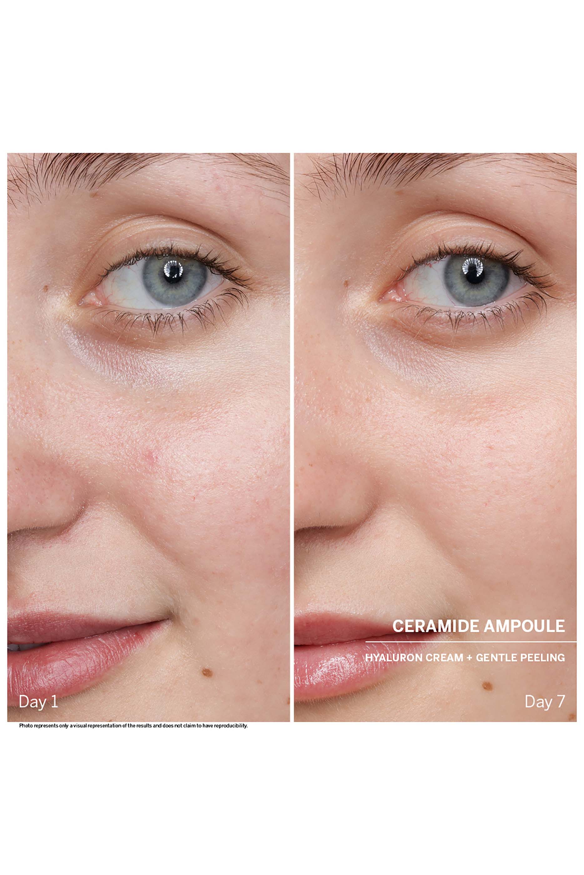 مجموعة أمبولة باور سيروم: سيراميد، 7 قطع