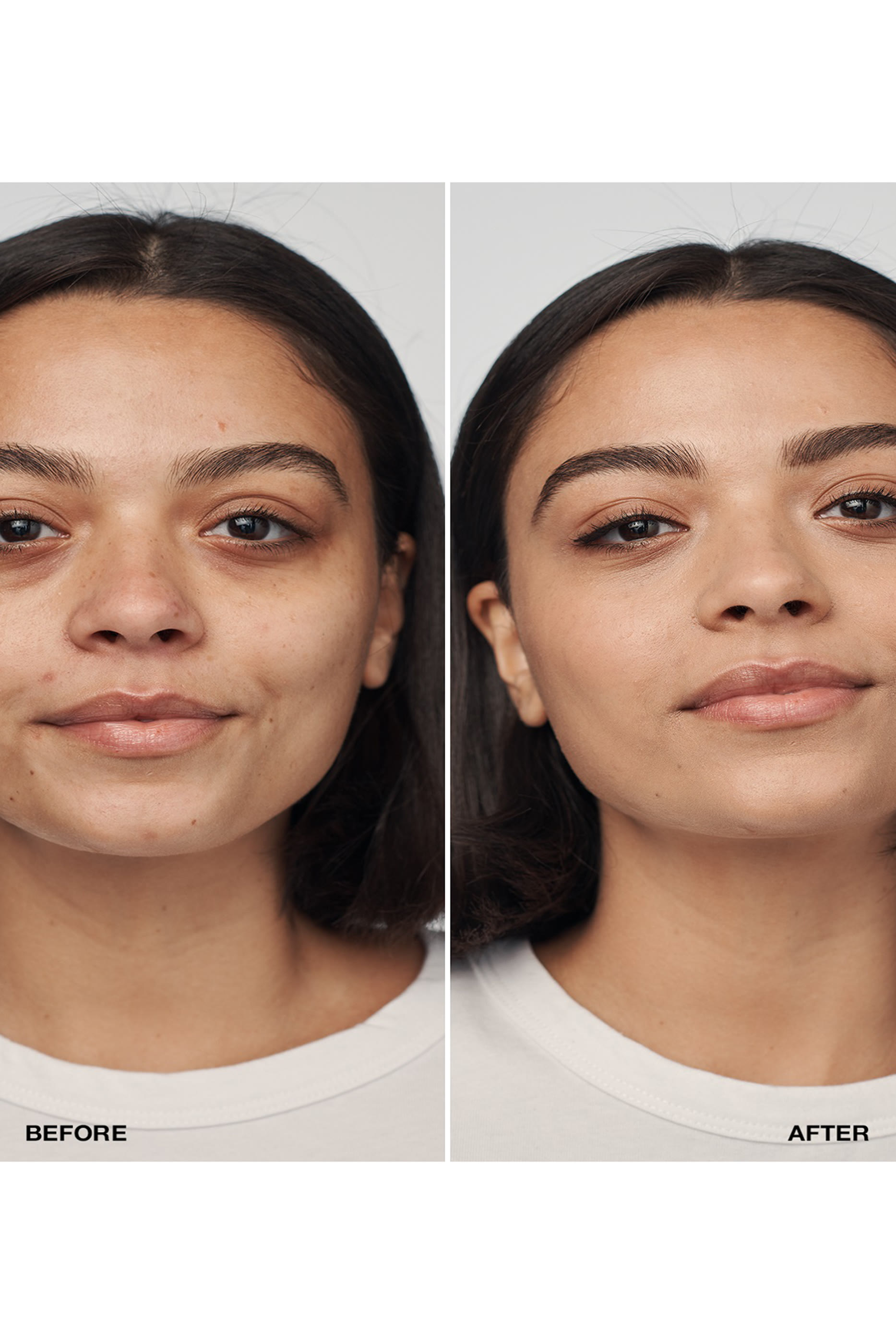 كريم أساس سيروم إيفين بيتر كلينيكال