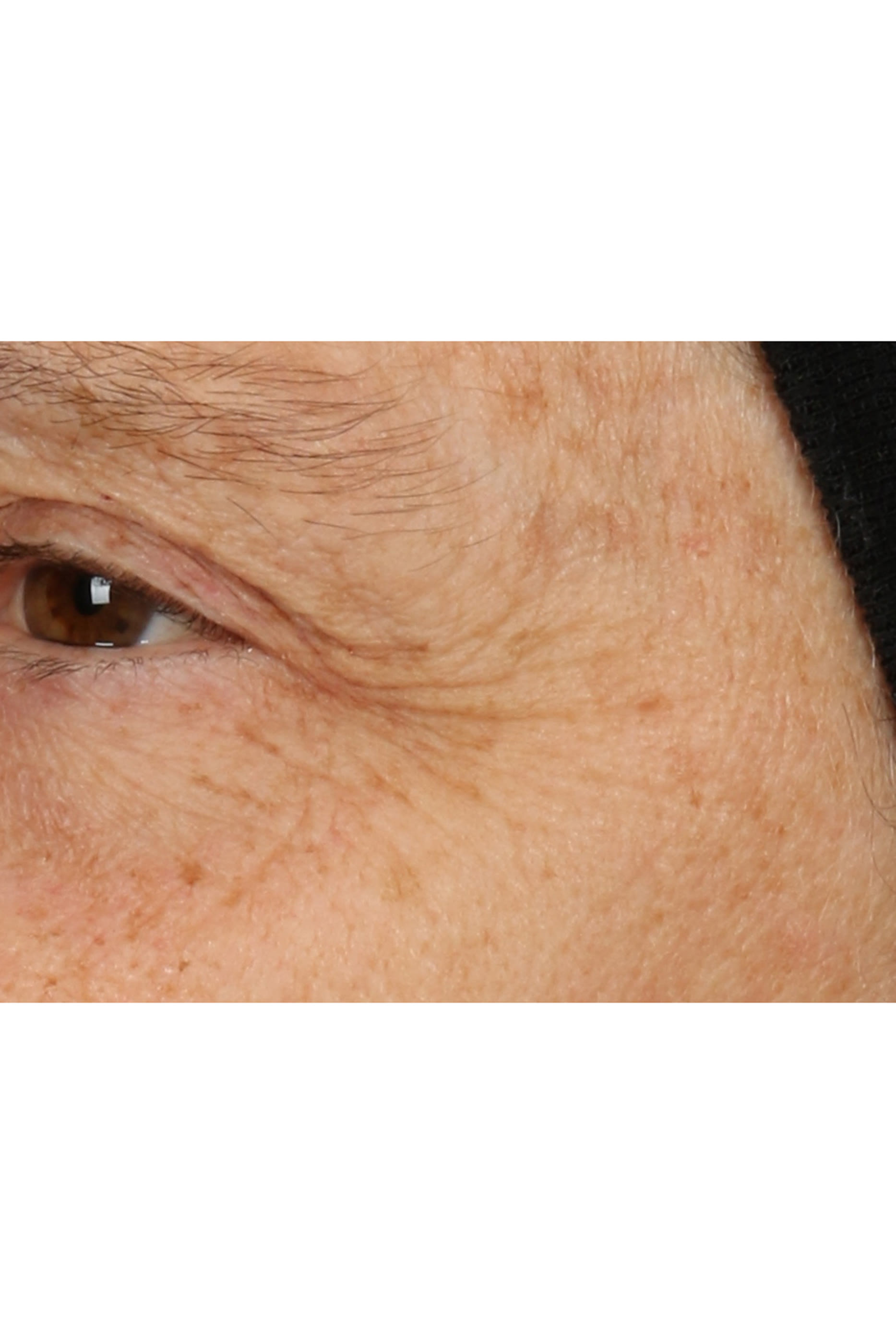 قناع + كريم سمارت كلينيكال ريبير ليلي لإصلاح البشرة