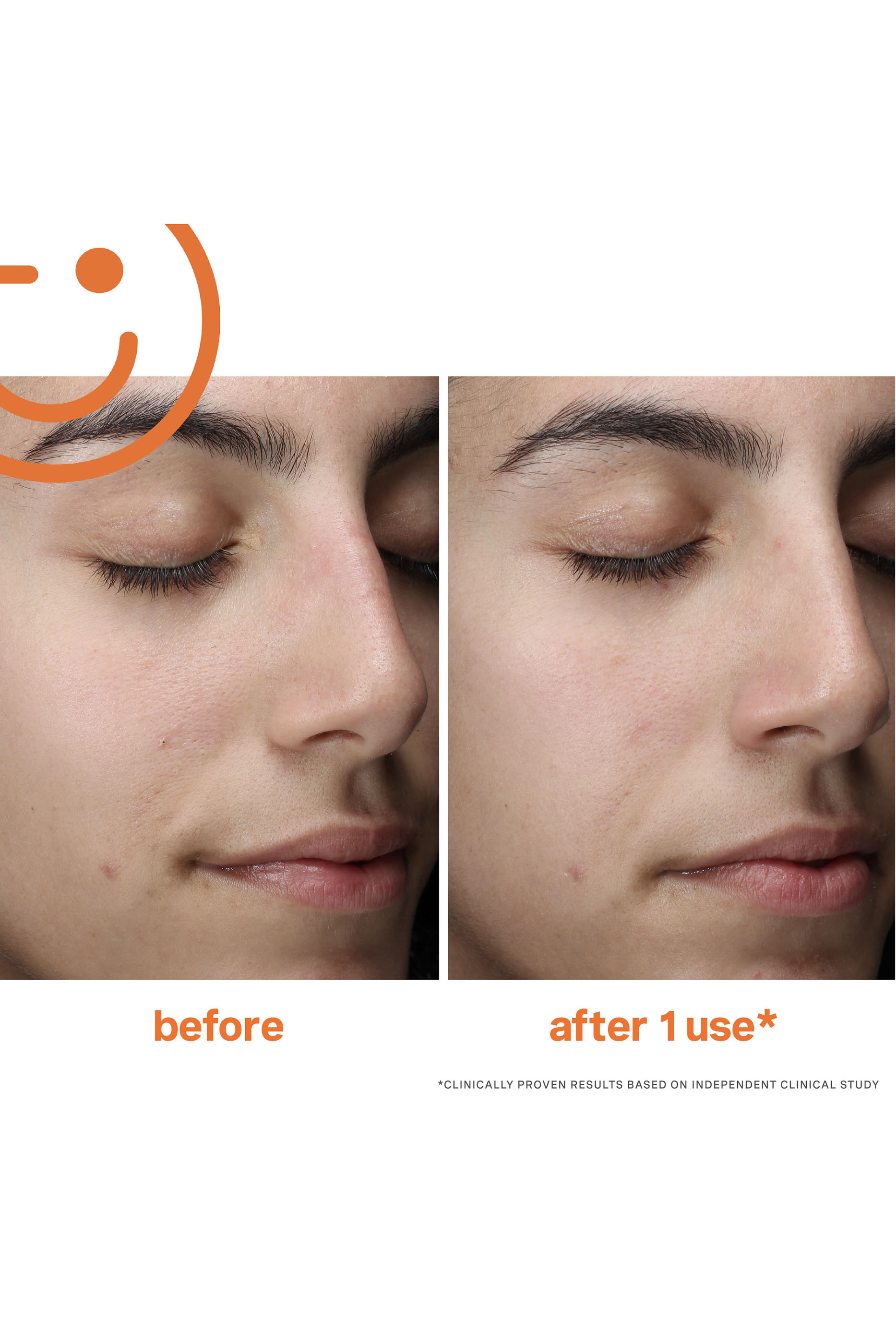 غسول اكسفوليكايت منظف رغوي يومي