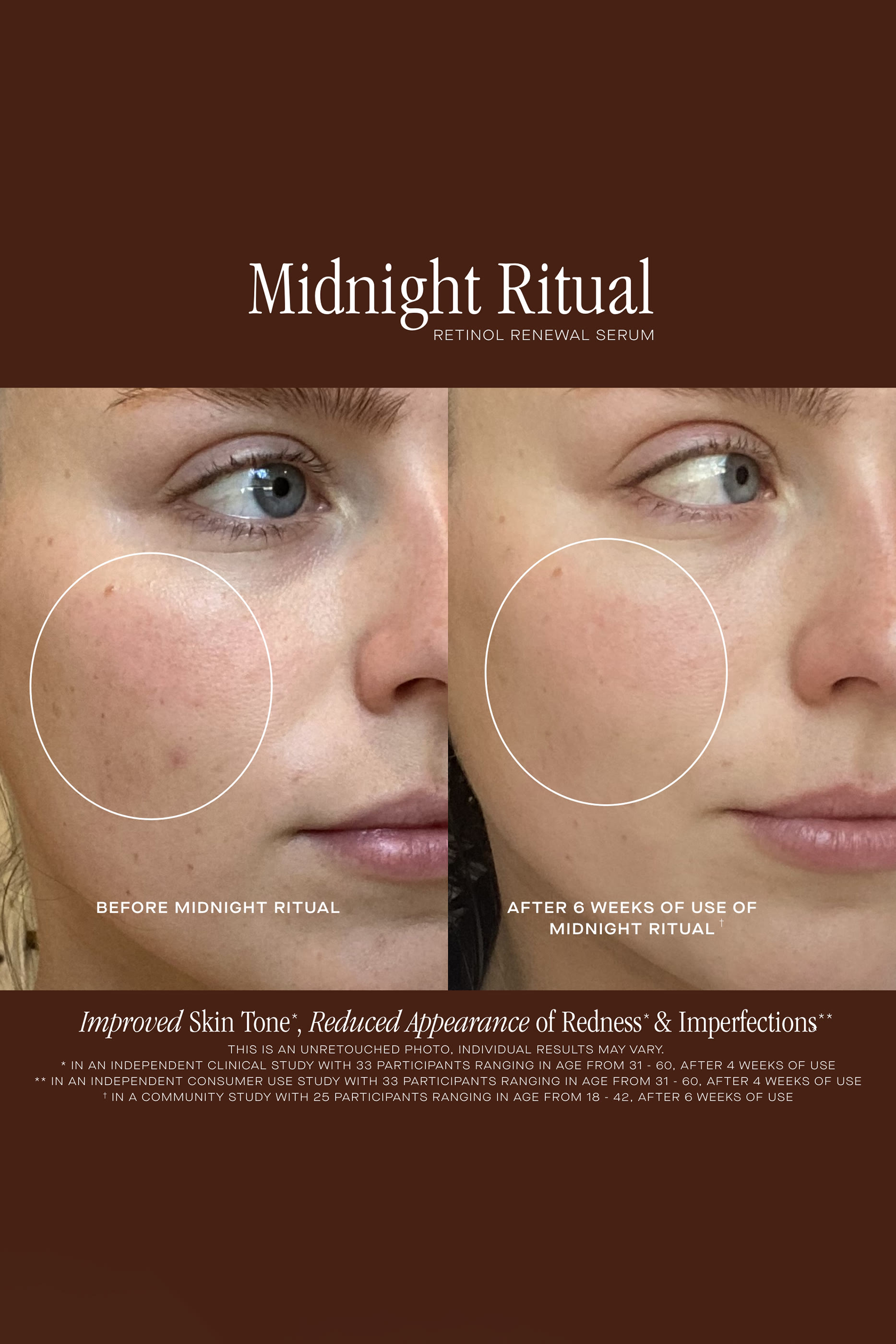 سيروم ليلي ريتوال ريتينول