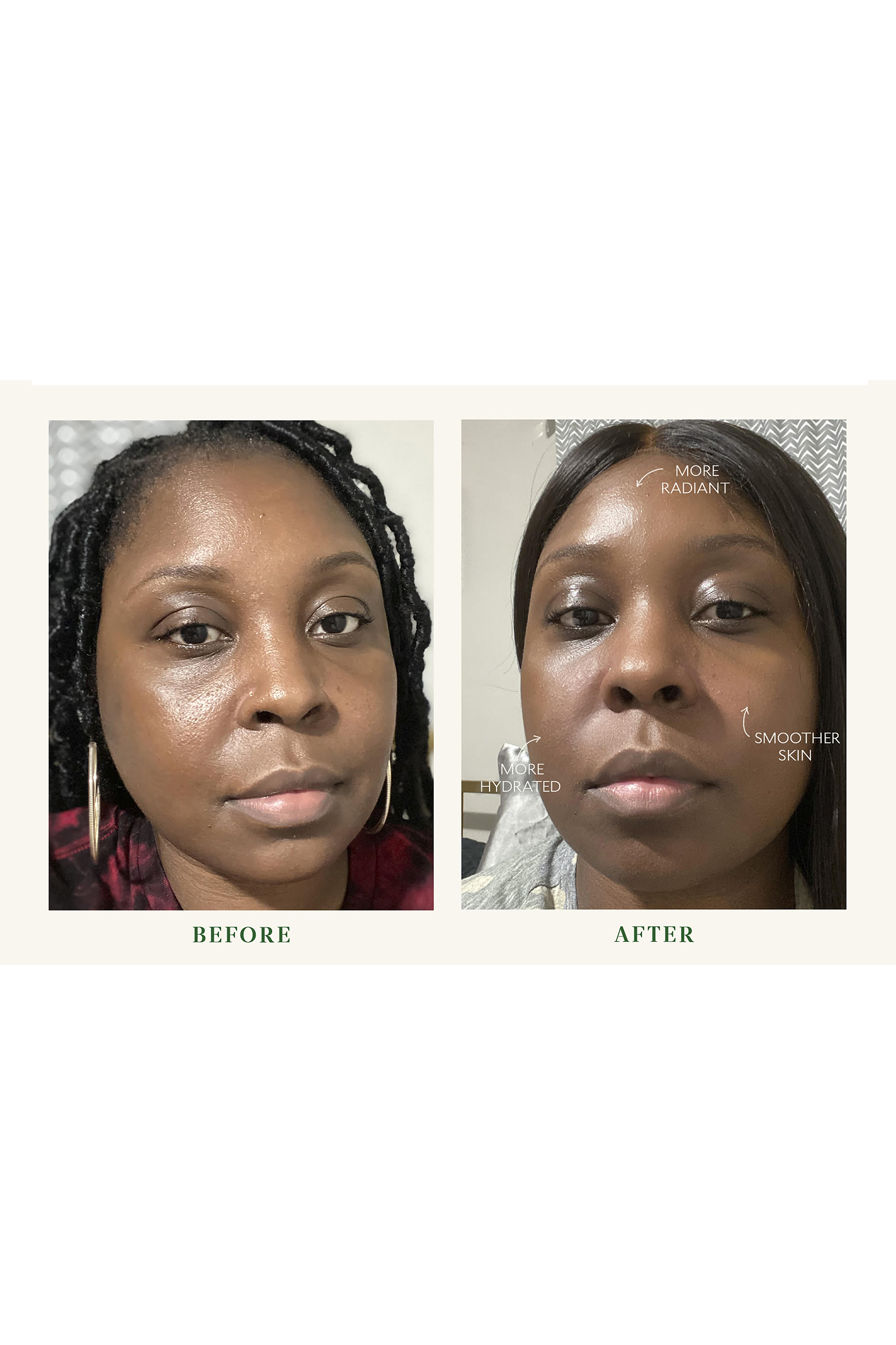 سيروم بايو باريير