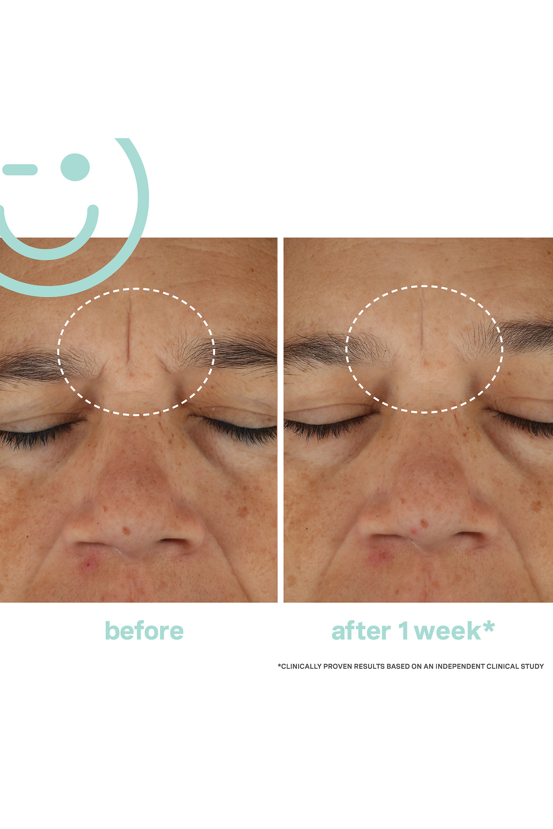 كريم هيدراكيت ريشارجين مائي