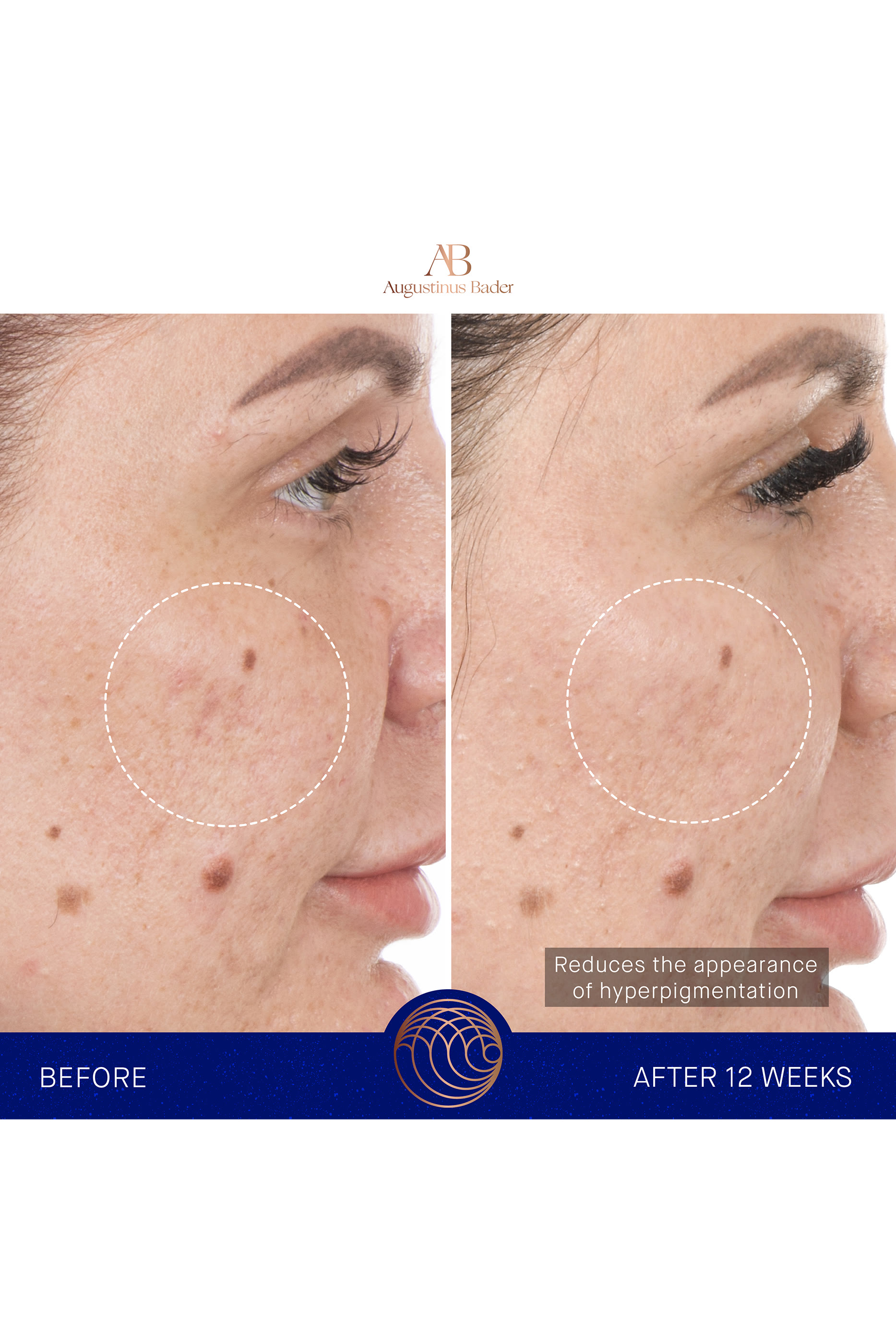 سيروم ريتينول 