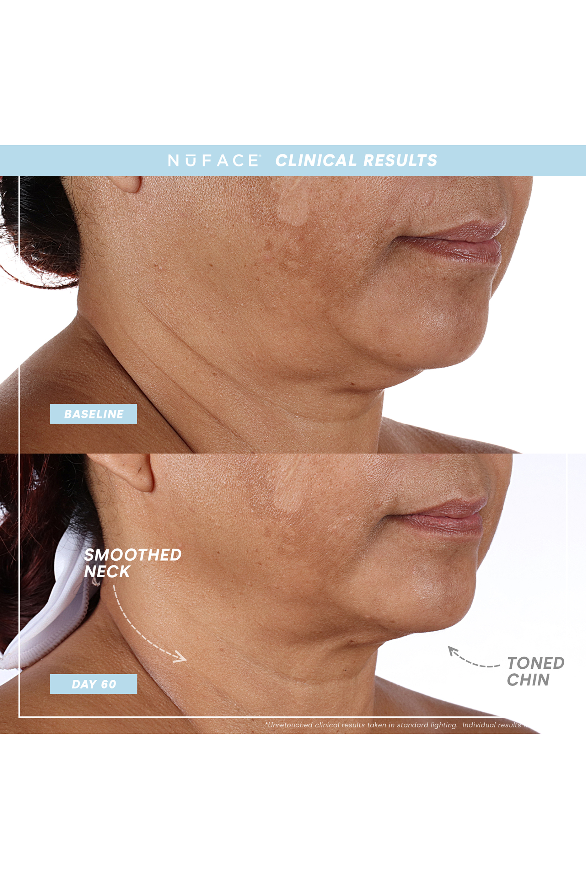 مجموعة العناية الأساسية نوفيس ترينيتي + برو